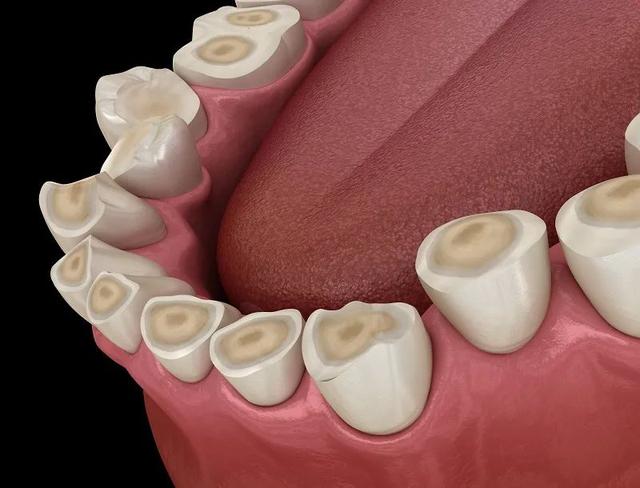 Grinding Teeth While Sleeping Is It A Bad Tooth Or A Worm In Your Stomach Daydaynews