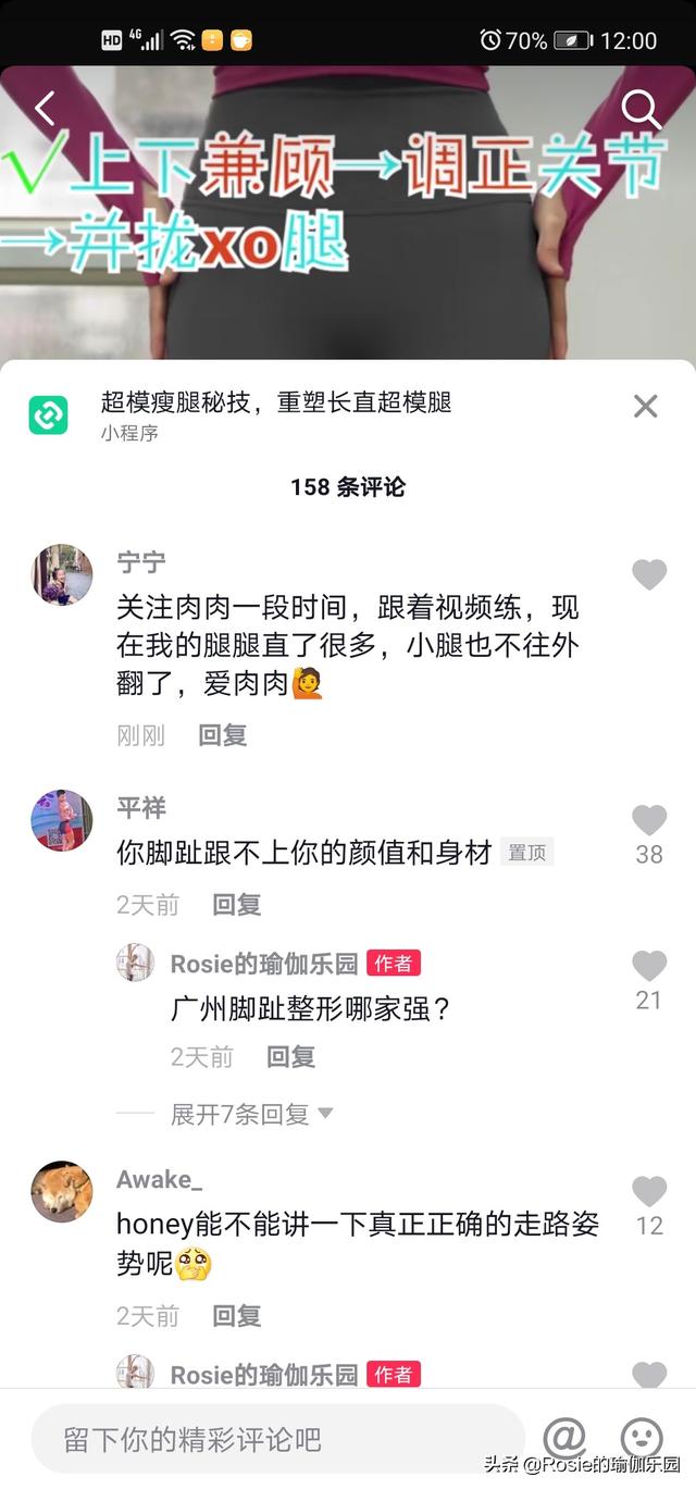 楊冪、江疏影腿精pk選誰？蘿卜腿如何變美腿？2步正腿1次見效 健身減肥達人 第22张