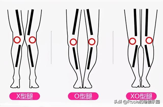 腿精唐嫣美人魚造型太驚艷，如何改善O腿變細直？4個動作帶你練 健身減肥達人 第11张