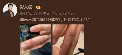 李晨拍戲被炸傷後，現場反應令人敬佩！觀眾：終於不只是綜藝咖了 娛樂八卦吃瓜 第2张