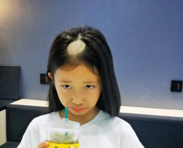 養了一隻貓，10天後，貓咪讓小主人變成了「禿頭少女」 萌趣萌寵 第1张