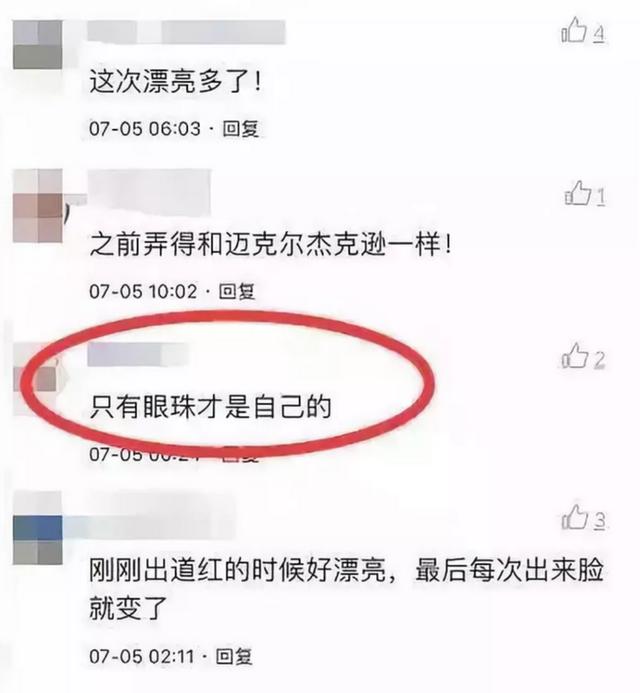 曾是超女總冠軍，如今整容失敗像「怪物」，只有眼珠是自己的 娛樂八卦吃瓜 第15张