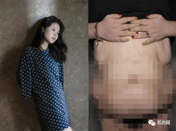 那些快速瘦下來的人，最後身材都變成什麼樣了？ 健身減肥達人 第6张