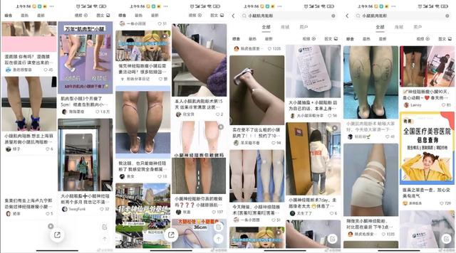 網紅式審美被噴上熱搜：這是自殘，不是性感 街拍正妹 第6张