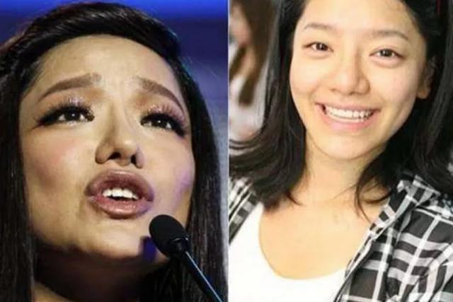曾是超女總冠軍，如今整容失敗像「怪物」，只有眼珠是自己的 娛樂八卦吃瓜 第6张