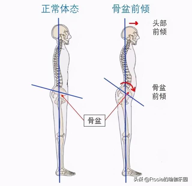 跳繩、跳操水桶腰、大肚子甩不掉？每天堅持這3步，輕松縮腰瘦腹 健身減肥達人 第17张