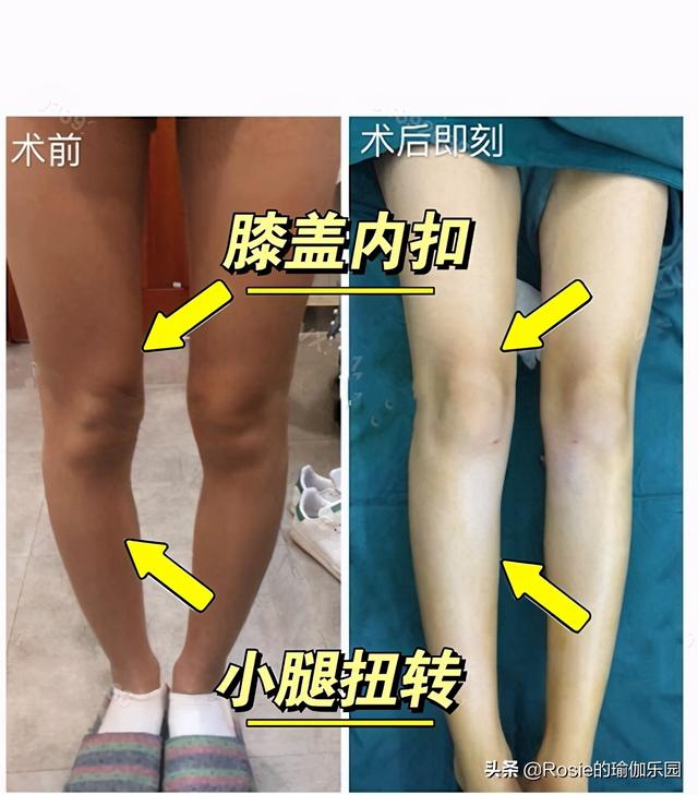 「仙劍三美」齊聚，唐嫣長腿搶鏡，超模私教帶你3步get同款美腿 健身減肥達人 第20张