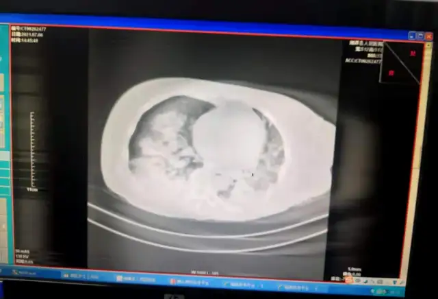 湘潭县人民医院：溺水高发季，我们在行动