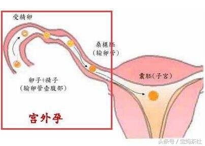 试管婴儿究竟要花多少钱？受多少罪？让你全面了解试管婴儿