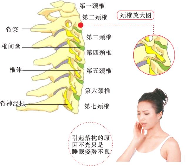 哪些现象告诉我们第三颈椎被压迫自我检查缓解疼痛