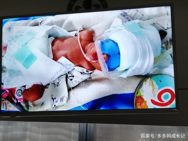 早产生下2斤半的极低体重儿，当时啥情况