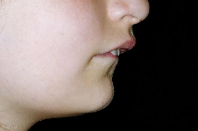 我是如何纠正孩子的牙齿外突问题的