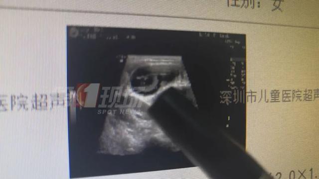 玩具又出事！1岁女童误食“水宝宝”…这几点家长必须注意