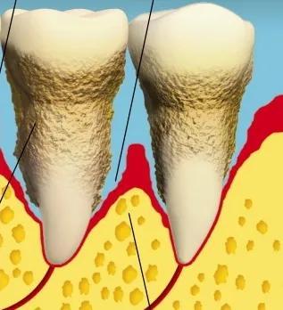 喝黑咖啡的会伤牙吗？