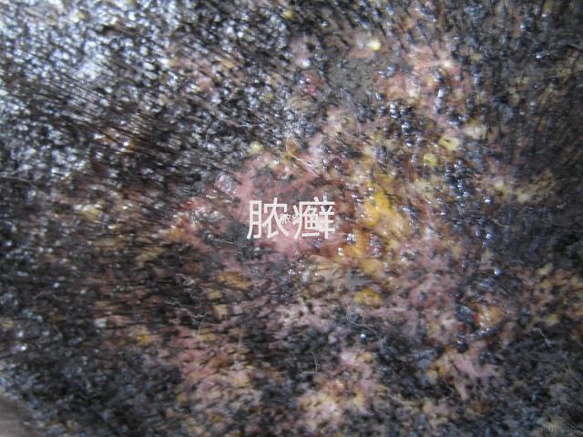 孩子得了头癣怎么办？