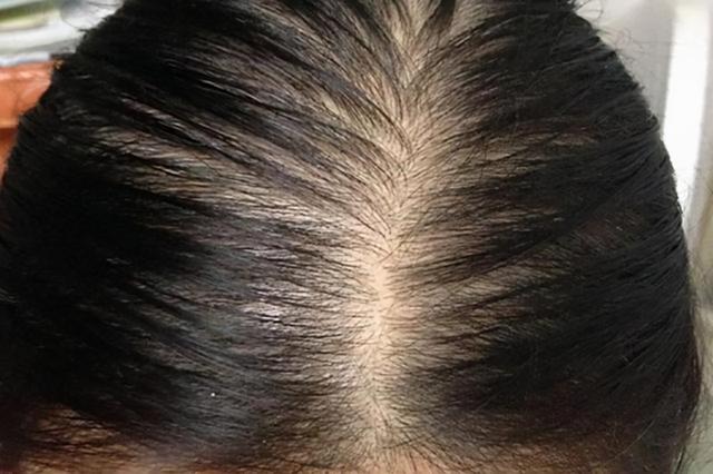 睡前用“生姜”涂抹脚底，一段时间后，或有这5大好处不约而至