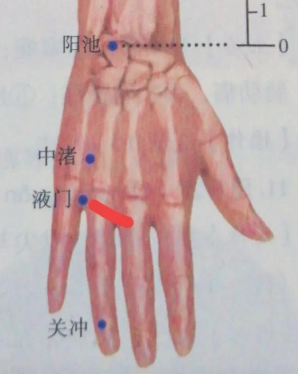 每日一穴——液门穴