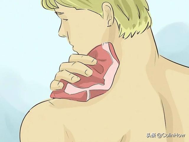 吻痕怎么消除比较快（消除吻痕的小窍门）