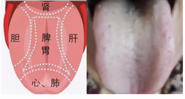 中医教你看舌诊，这几种情况要注意