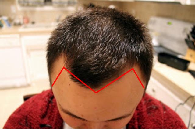 男生m字发际线怎么选发型?这5种剪法可以拯救,别再剪错了