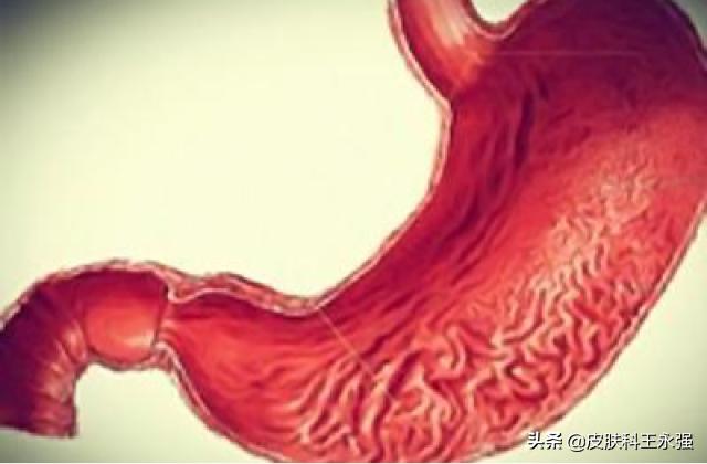 老胃病消瘦贫血，萎缩性胃炎，学会吃饭和吃药同样重要
