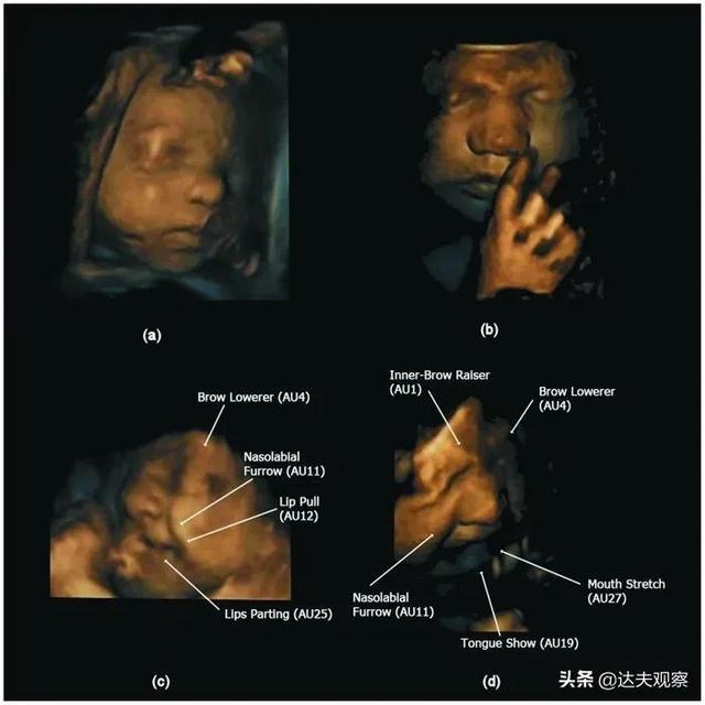 胎儿在子宫里会哭？超声波发现奇怪现象：或在出生前练习“哭泣”