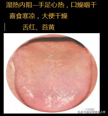 肺气虚、心阴虚、脾气虚，动一动就出汗怎么办？中医：治汗六法