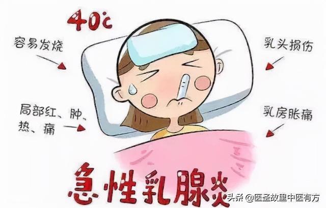 中药名方 瓜蒌牛蒡汤 治疗急性乳腺炎疗效显著 建议收藏转发 新闻时间