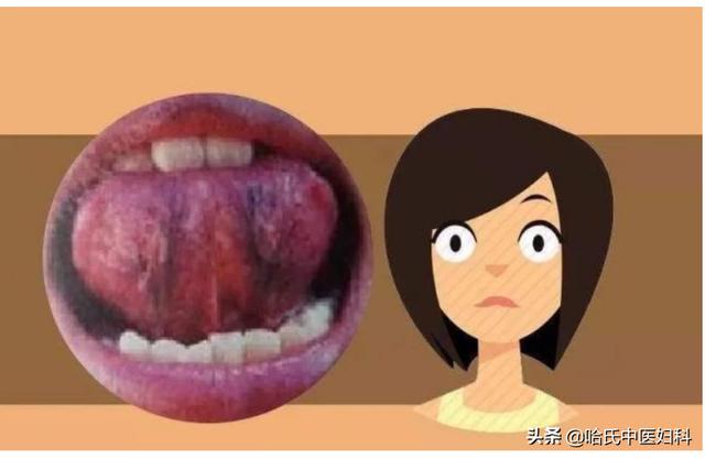 血虚、血瘀、血热、血寒，你是哪一种？中医教你如何调理？