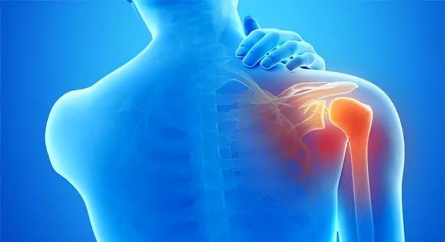 ​天气冷了，越来越多的人患肩周炎