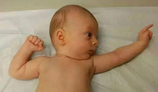 【榕哥烙科】第385期：婴儿为啥喜欢“投降”睡姿？