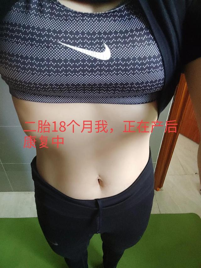 生完孩子，都瘦了，就只有肚子瘦不了！你有吗？