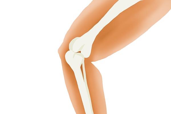 列出尿酸高的三种典型症状，对照看看，若有，及时改善