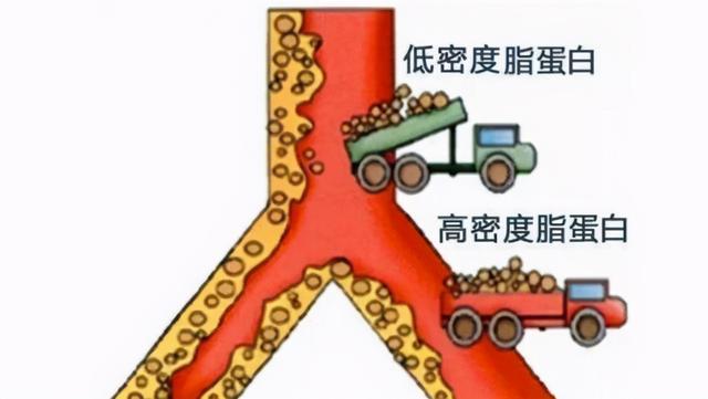 为何清淡饮食血脂还高呢？医生坦言：可能是四大原因所致