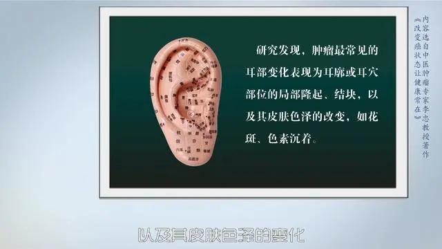 醫生提醒：癌變前，耳朵舌頭會“求救”！厚白苔肺癌，肝癭線肝癌
