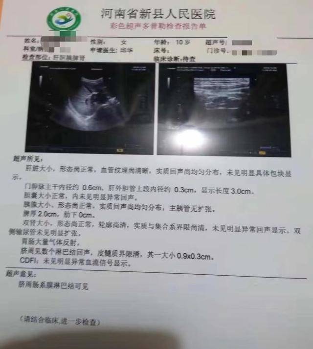 小儿腹痛，警惕肠系膜淋巴结炎