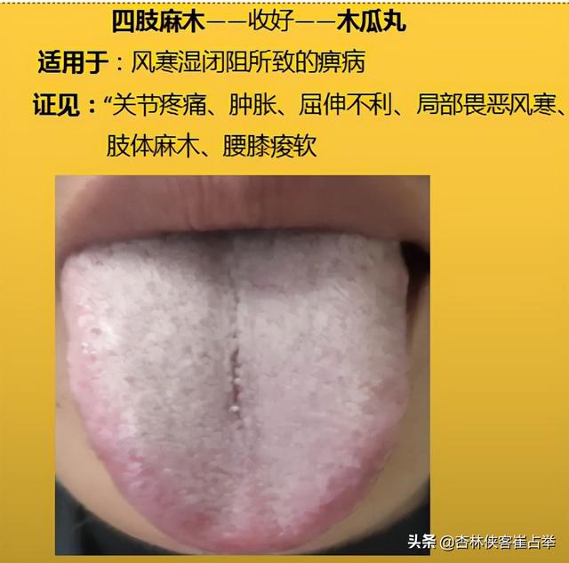 咽炎、高脂血症，四肢麻木，10个中成药，年过35岁后要收藏备好