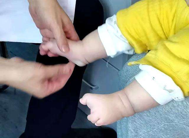 “30岁怀孕，孕6个月时发现宝宝脚有问题。”妈妈说着说着就哭了