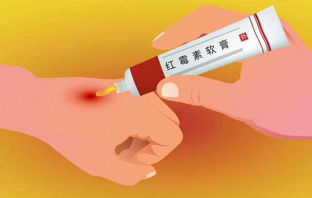 8种药店里便宜又好用的药，店员一般不会主动推荐，不妨记下来