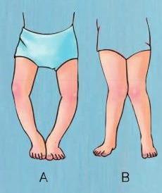 不吃鱼肝油的宝宝身体会出现发育迟缓你知道吗？