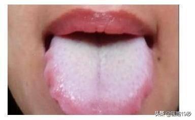 浑身酸痛不舒服是寒湿重的表现吗？寒湿体质应该怎么调理？