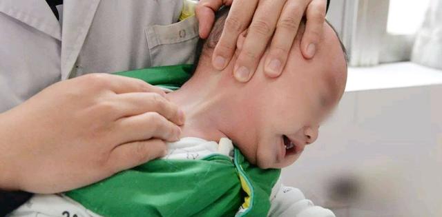 宝宝“歪头杀”看你，虽然看起来很萌，其实可能是病，家长别大意