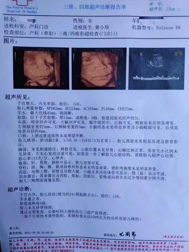 今天的四维大排畸