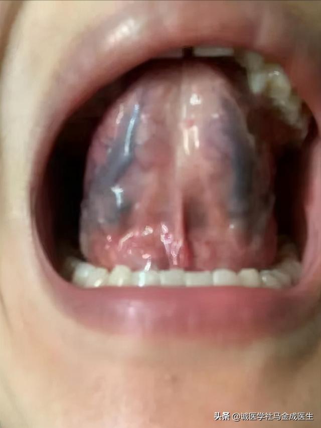 六种不同常见体质，看你属于哪种，看哪种方法适合你