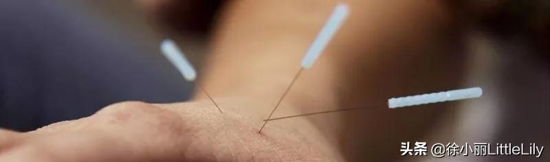 经络到底是什么