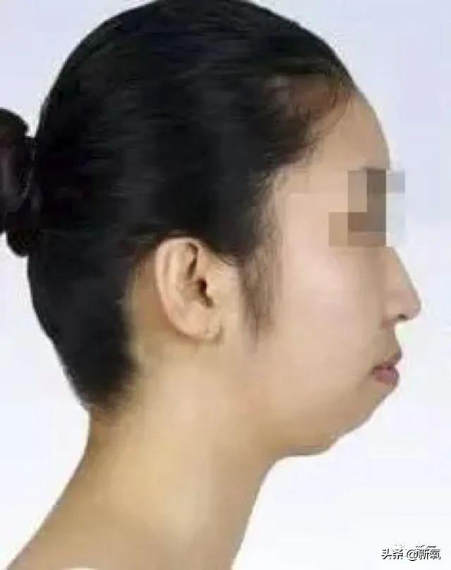 关晓彤和张嘉倪侧颜对决，被摁在地上摩擦啊…(欧阳娜娜侧颜)