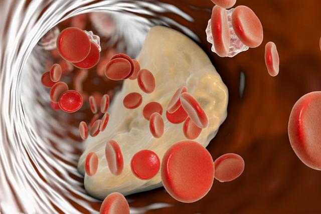鸡蛋是高血脂的“发物”？医生：除了鸡蛋，这4物还请撤下饭桌