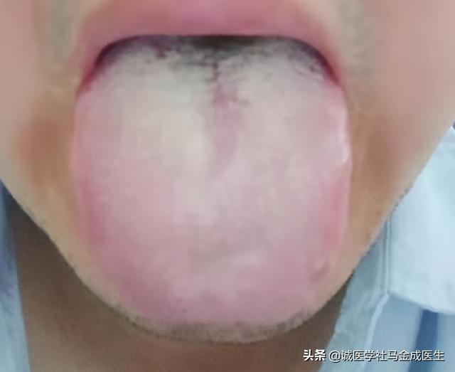 头颈大汗淋漓，动辄汗出，三点原因，医生三个方法都教给你