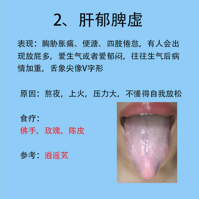 女人常见6种症状，以及对应舌象和解决的方法分享