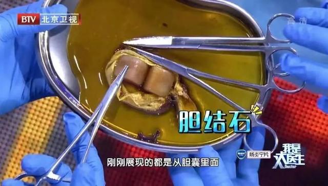 几点吃早饭更好？睡回笼觉到底好不好？这些疑问，看完就不纠结了